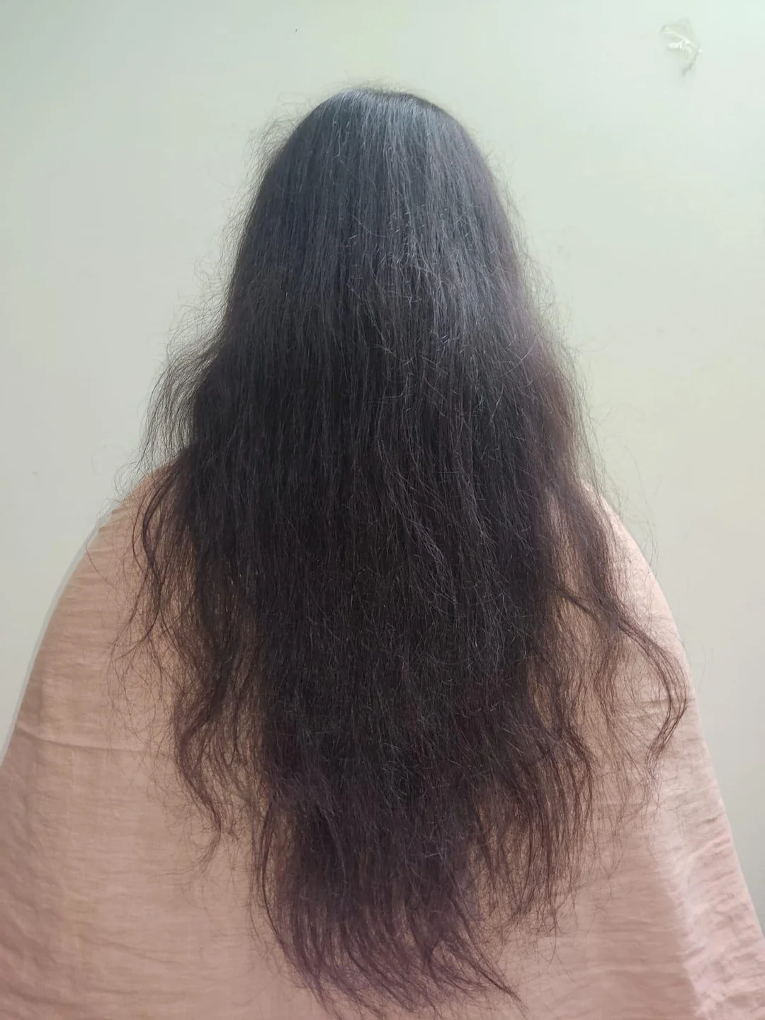 21f-struggling-with-chronic-hair-loss-seeking-support-and-v0-wov4gmiadcze1