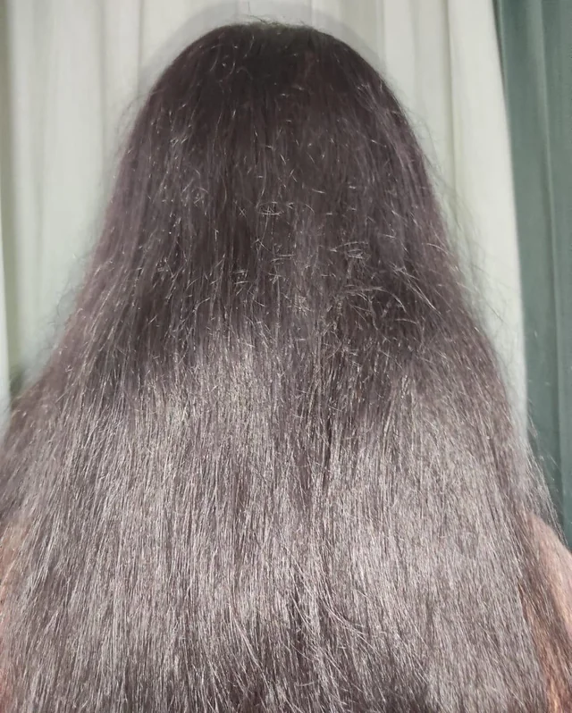 21f-struggling-with-chronic-hair-loss-seeking-support-and-v0-y47hdmiadcze1